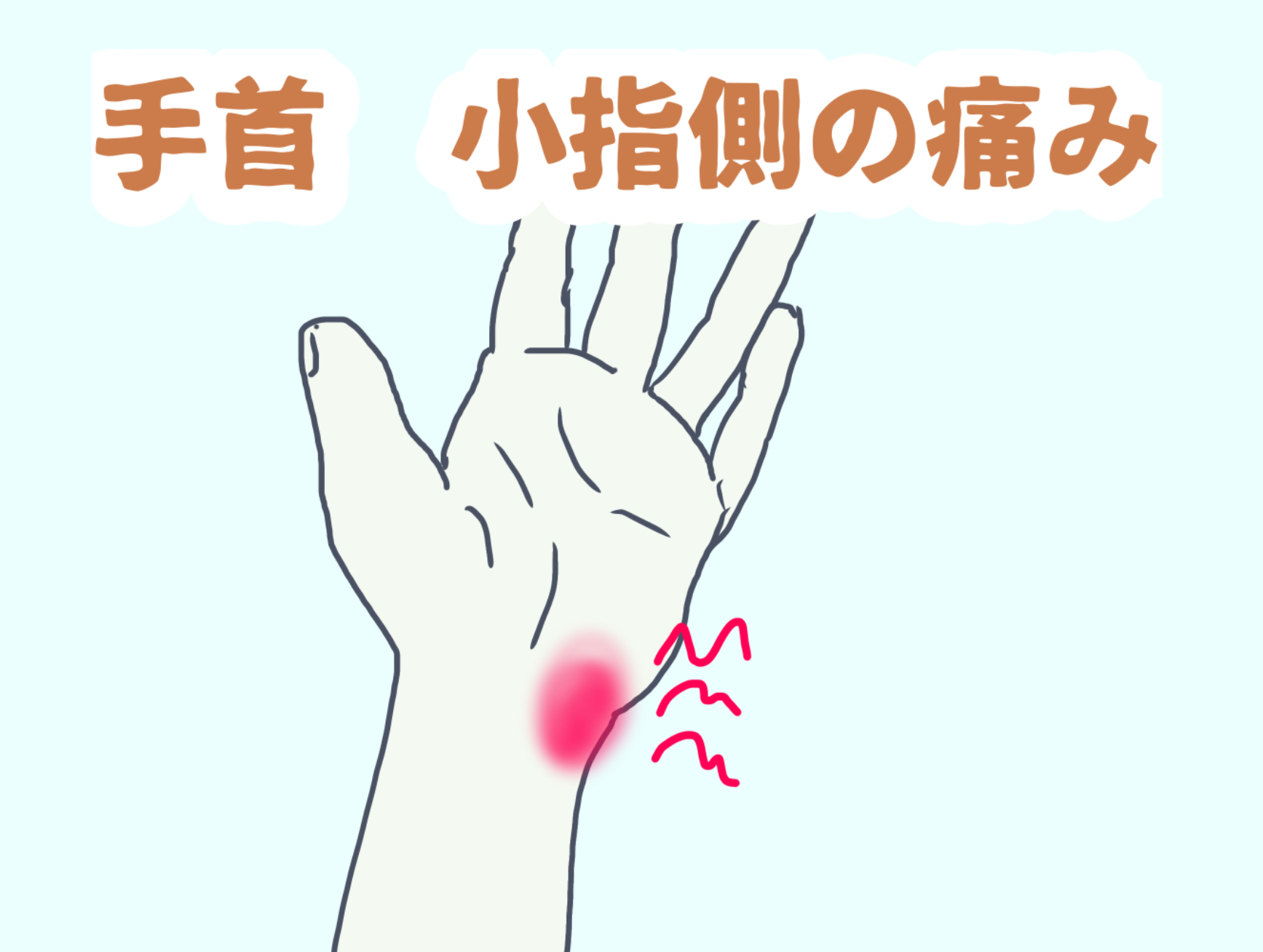 手首 小指 痛い 片方だけ | 小指から手首にかけて痛い _ 腱鞘炎や捻挫だけじゃない!手首が痛くなる原因9つを紹介 – ZRFW