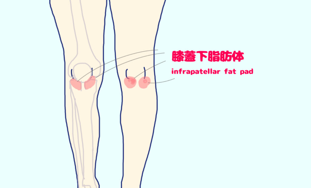 膝蓋下脂肪体の位置 膝の前側から見ている