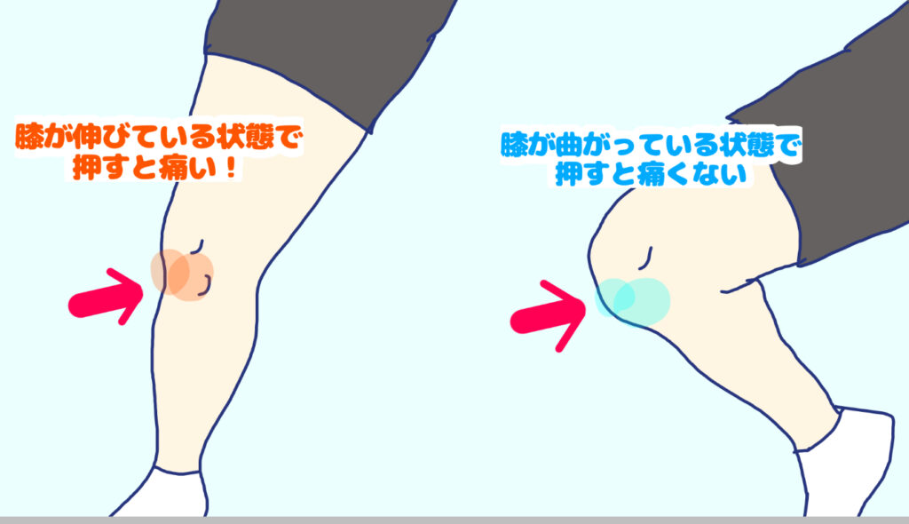 膝蓋下脂肪体のテスト方法