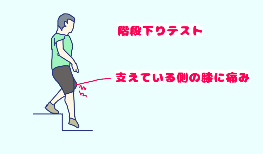 階段を下る時に膝の痛みが出ている