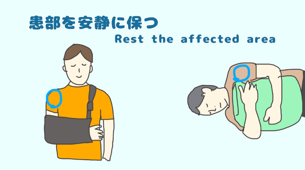 肩関節を安静に保つための取り組み 三角巾 や 抱き枕
