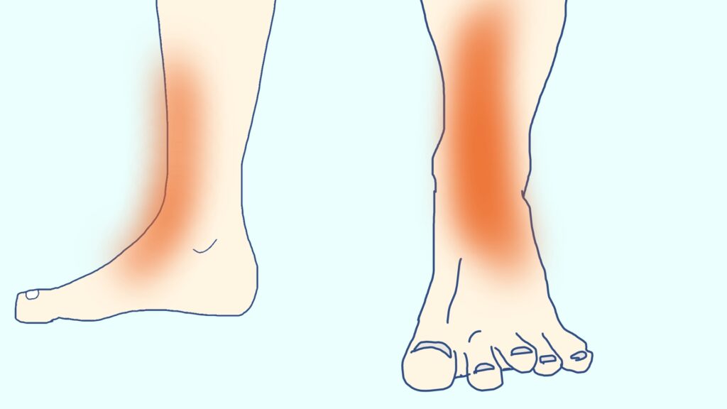 足の前側やスネ疲労している