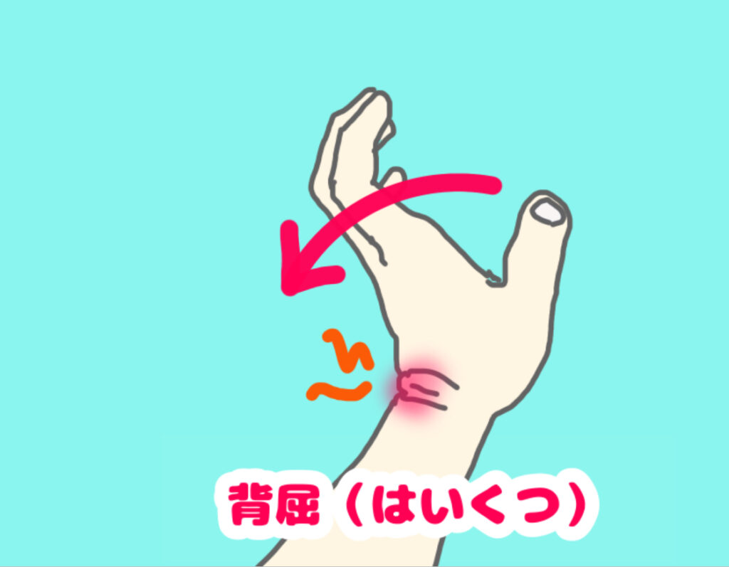 手首の背屈で手関節背側に痛みが出ている