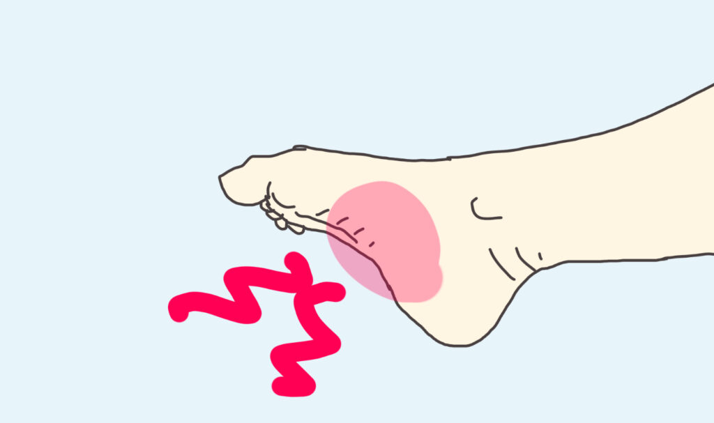 足裏がつっている