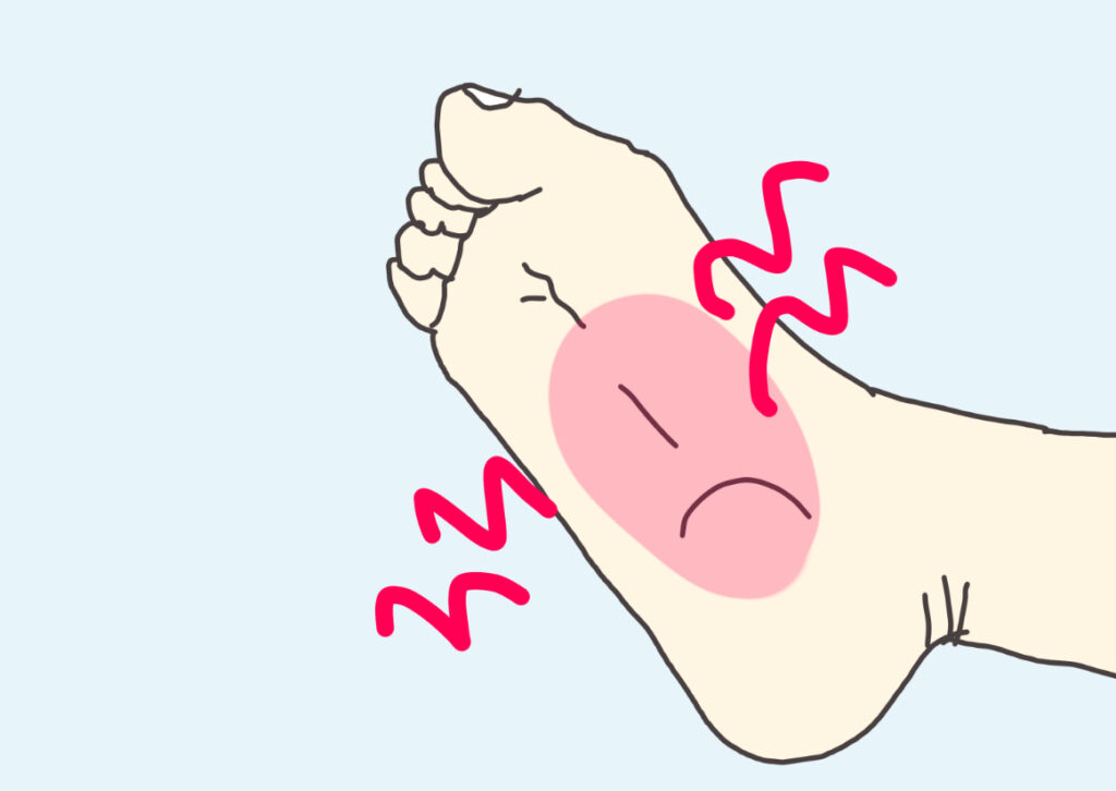 足のウラがつっている