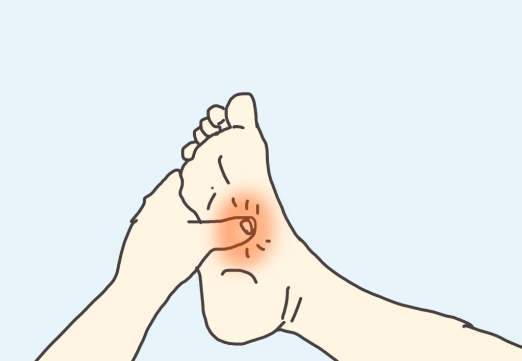 足裏がつった時は、伸ばす代わりに押しても効果がある