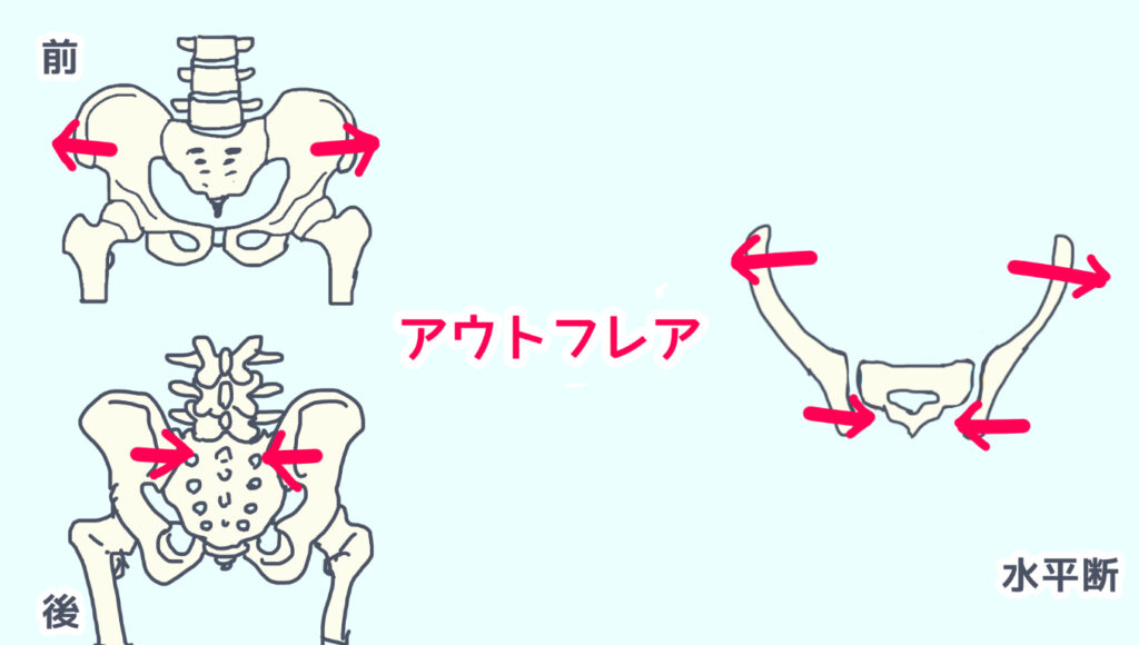 仙腸関節のアウトフレアを説明した図