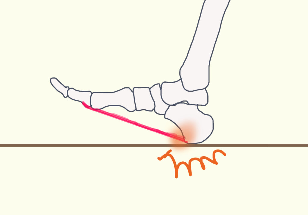 歩行相の前半　着地の衝撃で足底腱膜の付着部のあたりに直接ストレス