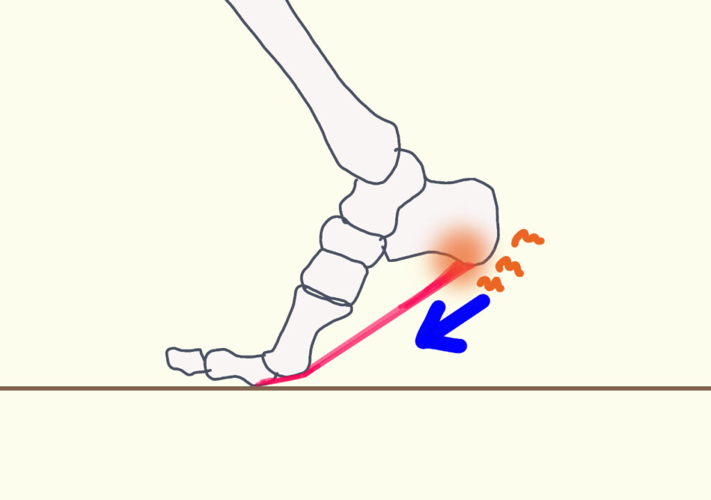 歩行の後半　蹴り出しの際に足底腱膜に牽引力