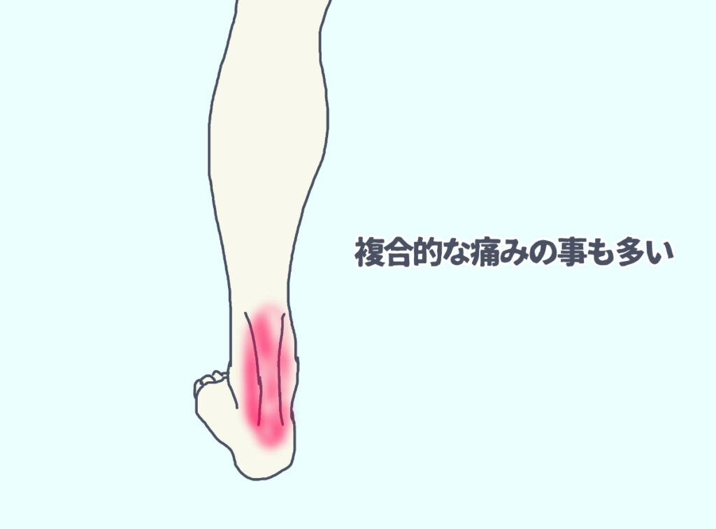 アキレス腱周囲の複合的な痛みのことも多い