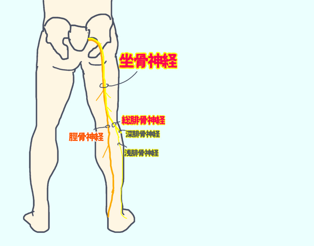坐骨神経のイメージ 内側の脛骨神経と外側の腓骨神経がまとまっている。膝のあたりで二つは分岐する