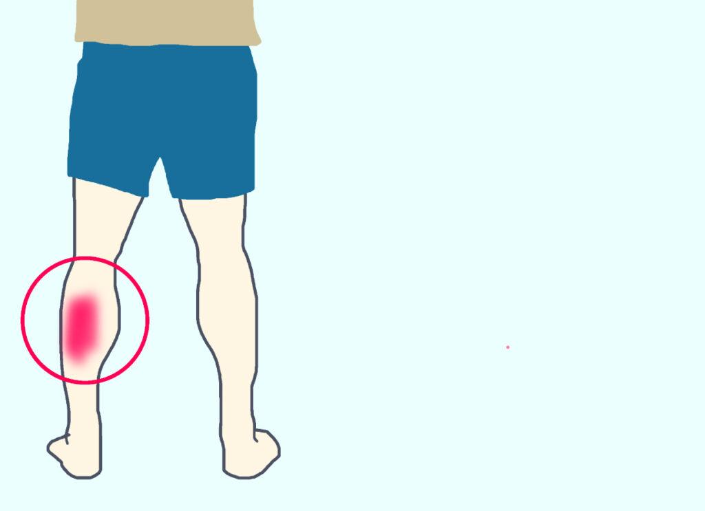 左ふくらはぎの痛み